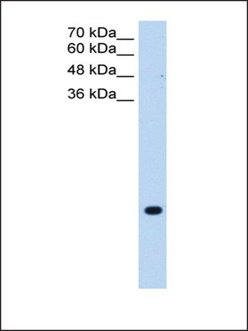 Anti-TMEM75 antibody produced in rabbit