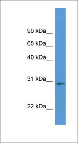 Anti-RPIA antibody produced in rabbit