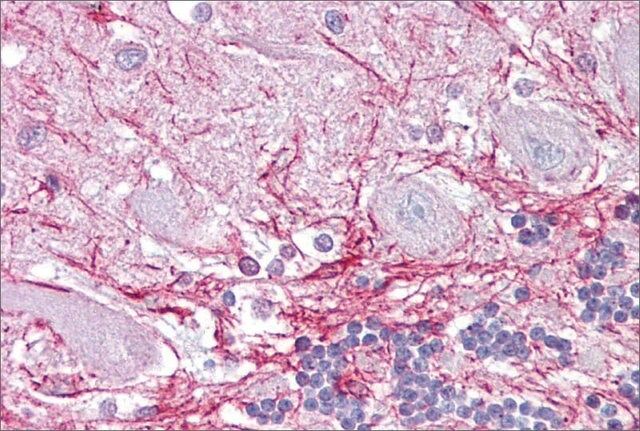 Anti-RP2 antibody produced in rabbit