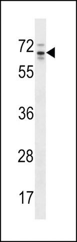 ANTI-RP13-102H20.1/ARHGAP36(C-TERMINAL) antibody produced in rabbit