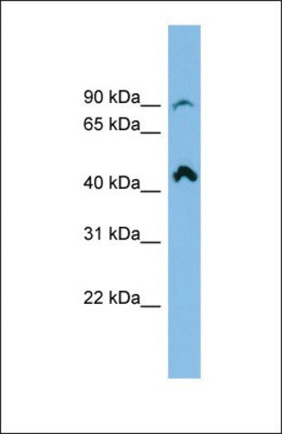 Anti-RP11-298P3.3, (N-terminal) antibody produced in rabbit