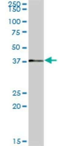 Anti-RP2 antibody produced in mouse