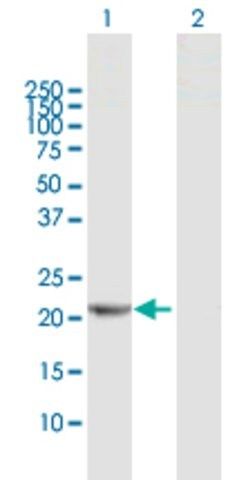 Anti-RPE antibody produced in rabbit