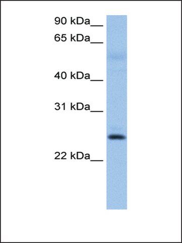 Anti-ROPN1B antibody produced in rabbit