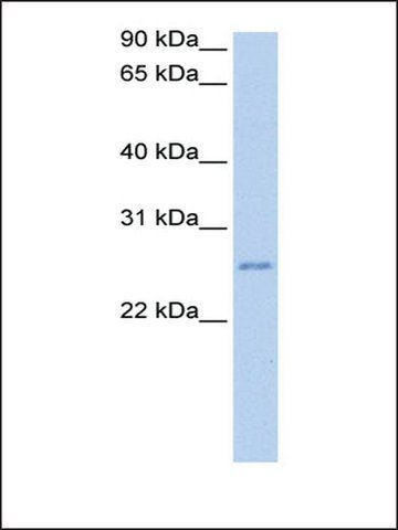 Anti-RPESP antibody produced in rabbit