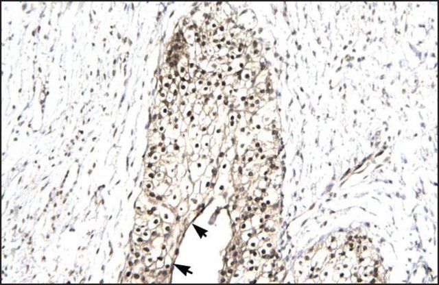 Anti-RUVBL2 (AB2) antibody produced in rabbit