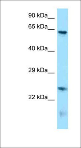 Anti-RUNX1T1 antibody produced in rabbit