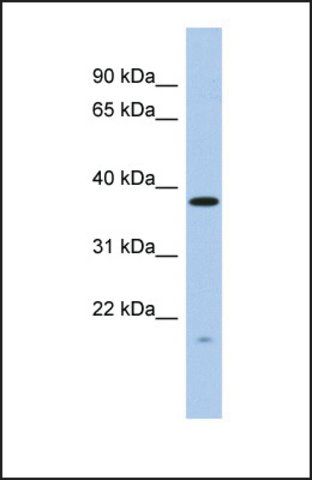 Anti-RWDD2A, (N-terminal) antibody produced in rabbit