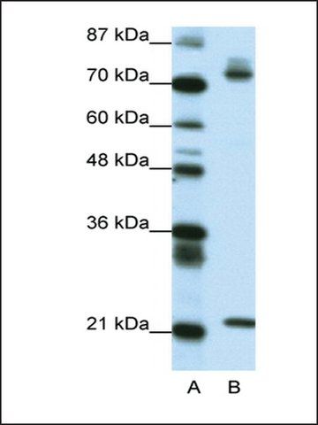 Anti-SATB1 antibody produced in rabbit