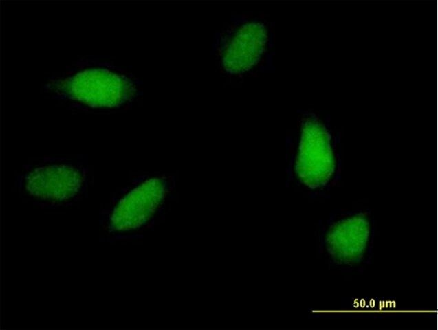 Anti-SCC-112 antibody produced in mouse