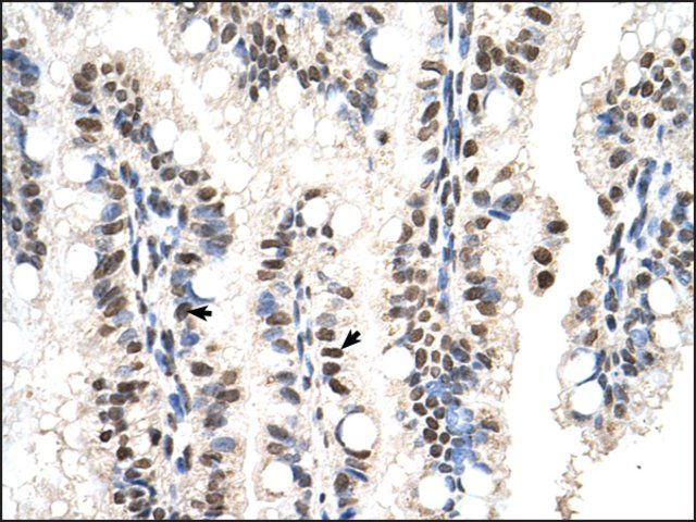 Anti-RUNDC2A antibody produced in rabbit