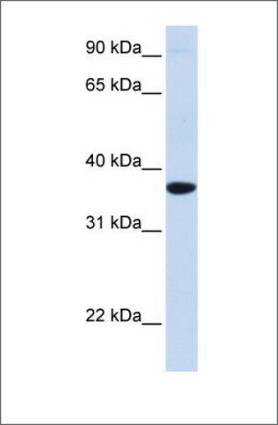 Anti-SCGN (ab2) antibody produced in rabbit