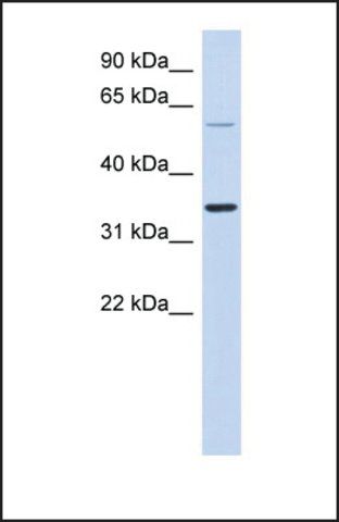 Anti-SASP antibody produced in rabbit