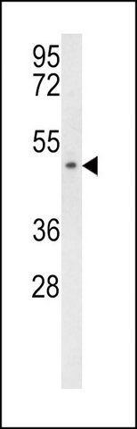 ANTI-SCD5 (CENTER) antibody produced in rabbit