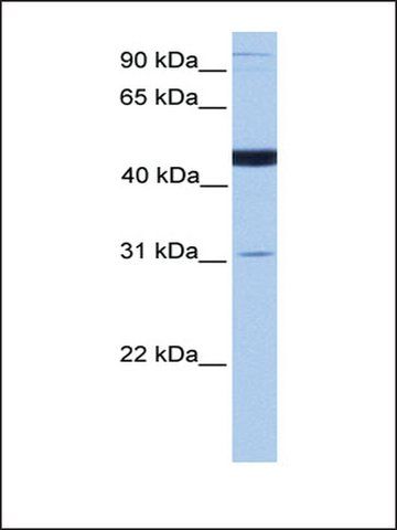 Anti-SCCPDH antibody produced in rabbit