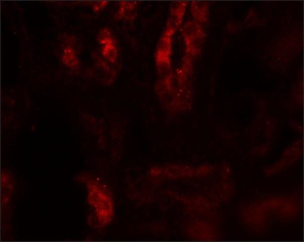 Anti-SARM antibody produced in rabbit