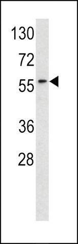 ANTI-RYK (CENTER C397) antibody produced in rabbit