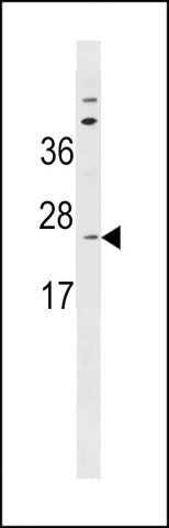 ANTI-SC11A (CENTER) antibody produced in rabbit