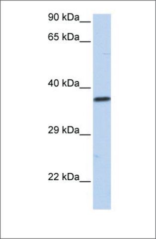 Anti-SCML1 (ab2) antibody produced in rabbit