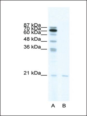 Anti-SCAND1 antibody produced in rabbit