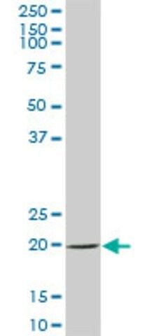 Anti-SAT2 antibody produced in mouse