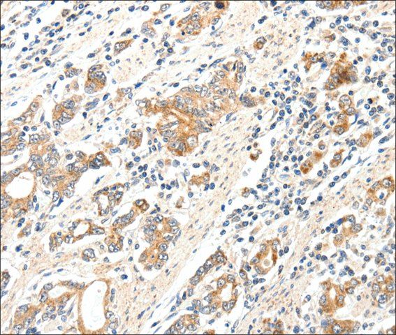 Anti-SCN2A antibody produced in rabbit