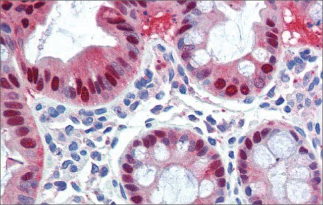 Anti-SCML1 (ab1) antibody produced in rabbit