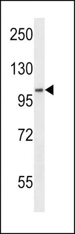 ANTI-SDCCAG1(N-TERMINAL) antibody produced in rabbit