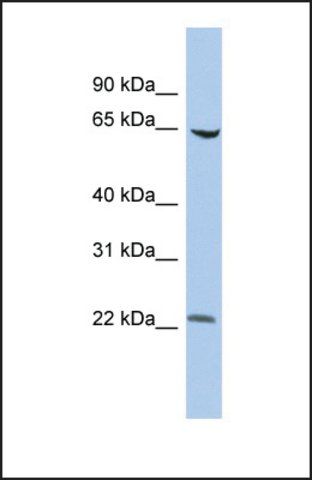 Anti-SCMH1 antibody produced in rabbit