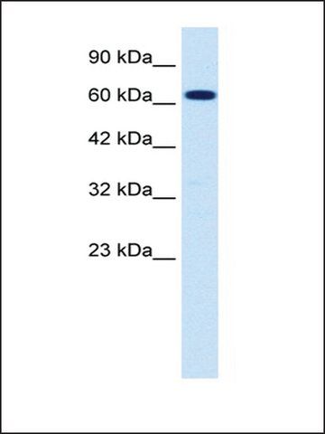 Anti-SCNN1B antibody produced in rabbit