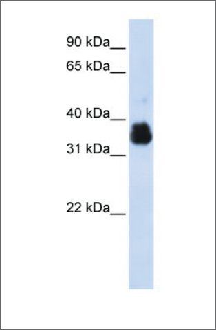 Anti-SCYE1 antibody produced in rabbit