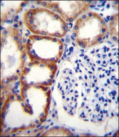 ANTI-SDHD (N-TERM) antibody produced in rabbit