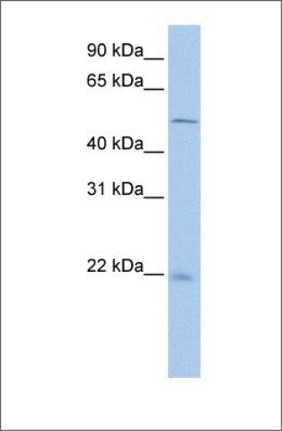 Anti-SDCBP2 antibody produced in rabbit