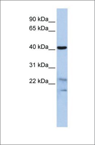 Anti-SCRN2 antibody produced in rabbit