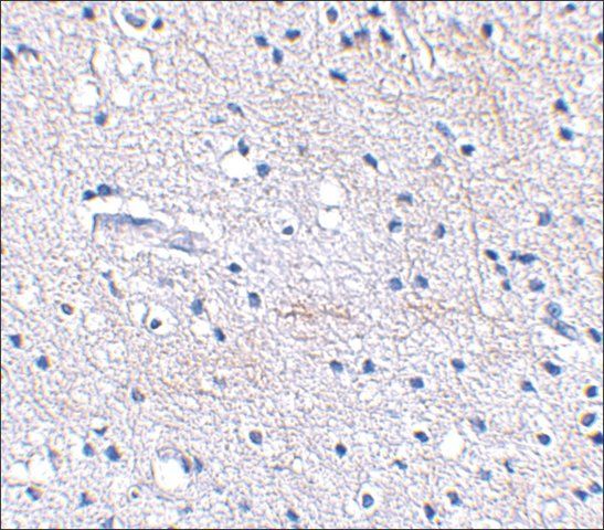 Anti-SCRAPPER (ab1) antibody produced in rabbit