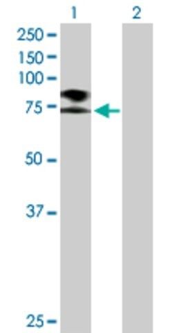 Anti-SCNN1B antibody produced in mouse