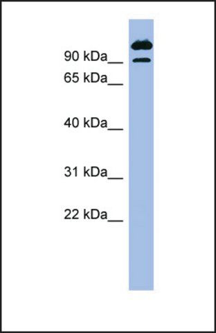 Anti-SCYL3, (N-terminal) antibody produced in rabbit