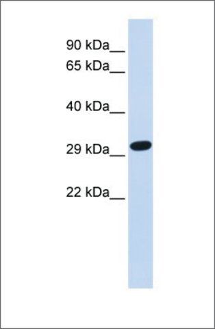 Anti-SDCBP antibody produced in rabbit