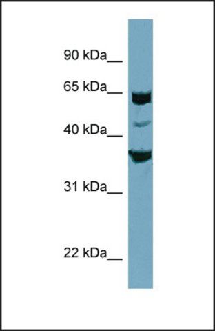 Anti-SEC22C antibody produced in rabbit