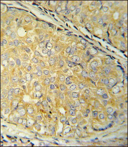 ANTI-SDHAF1 (CENTER) antibody produced in rabbit