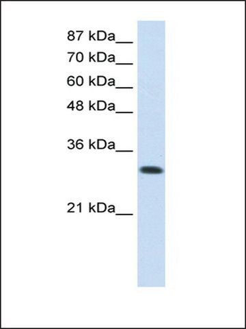 Anti-SCYE1 antibody produced in rabbit