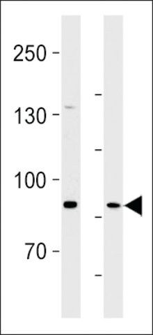 ANTI-SEMA6B(C-TERMINAL) antibody produced in rabbit