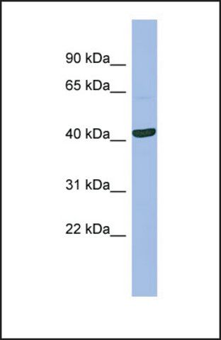 Anti-SERPINB13, (N-terminal) antibody produced in rabbit