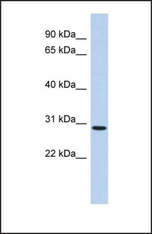 Anti-SERTAD2, (N-terminal) antibody produced in rabbit