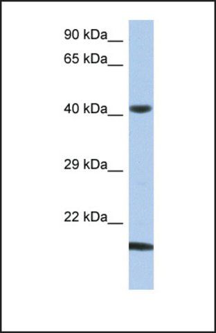 Anti-SEC14L4, (N-terminal) antibody produced in rabbit