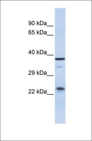 Anti-SERTAD1 antibody produced in rabbit