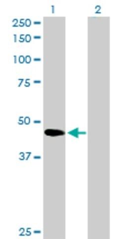 Anti-SERPINB2 antibody produced in rabbit