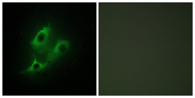 Anti-SERC2 antibody produced in rabbit