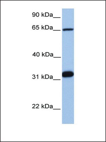 Anti-SF1 (AB2) antibody produced in rabbit