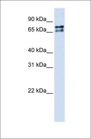 Anti-SF1 antibody produced in rabbit